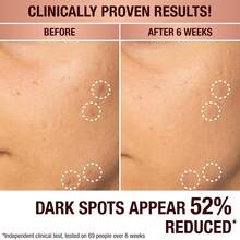 Charlotte Tilbury Radiance Recovery Dark Spot Serum - Tranexamic Acid & Vitamin C Serum For Brighter Looking Under Eyes, Redness, Uneven Skin Tone - Treatment To Reduce Appearance Of Aging Skin - 1.01 Ounce (Pack Of 1) - View 4