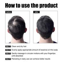 Hair Loss Products - 1 - View 7