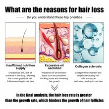 Hair Loss Products - 1 - View 5