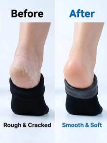 1 Pair Whitening Moisturizing Silicone Socks, Suitable For Dry And Cracked Foot Care, Gel Heel Leg Warmers For Foot Moisturizing - Black - View 4