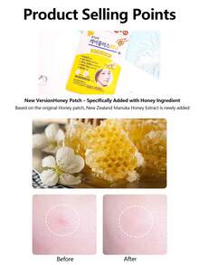 Olive Young Care Plus 1pc Invisible Hydrocolloid Acne Patch, Imported From Korea, Conceals And Covers Blemishes, Suitable For Problem Skin And Face, Sweat-Resistant, Emergency Acne Patch - 84 Count - 查看 3