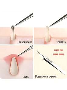6/3/1pc #5 Ultra-Fine Blackhead Removal Needle, Suitable For Normal Skin, Acne Removal Tool, Elegant Design Durable, Beauty Salon Facial Care Tool, With Storage Box - Multicolor - View 5