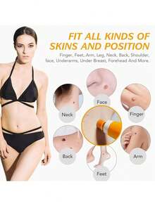 1 Set Alat Penghilang Jerawat, Kutil, Tahi Lalat, dan Kapalan Wajah Minimalis yang Praktis dan Indah, Cocok untuk Pria dan Wanita, Hadiah Liburan yang Cantik - MultiWarna - View 3