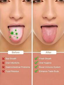 1pc Stainless Steel Tongue Scraper-With A Piece Of Box, For Removing Tongue Coating & Reducing Bad Breath, Oral Hygiene Tool, Easy To Use Oral Cleaning Kit - Multicolor - View 4