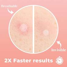 360pcs Hydrogel Scar Patches: Waterproof And Sweat-Resistant, Suitable For All-Day Use. Perfect Fit Without Clumping, Gentle And Non-Irritating, Providing A Refreshing And Comfortable Experience While Caring For Your Skin. - View 6