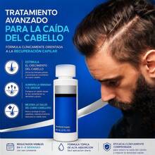 Scalp Treatment - 1 Pack - View 4