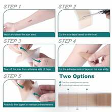 10/20/30/40pcs Silicone Scar Sheets, Silicone Scar Pads, Suitable For All Skin Types, Scar Gel Tape Patches, Reusable Silicone Scar Strips, Professional Use (1.6"X 6") - View 2