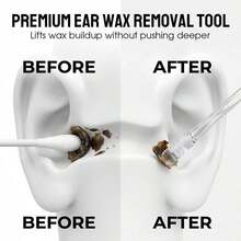 Reusable Adhesive Ear Canal Cleaning Swabs, Adult Home Earwax Removal Tool, Ear Cleaning Device - View 6