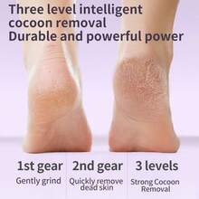ICEWLESS Electric Foot Callus Remover Rechargeable Foot File 2 Glass Grinding Heads Dual Speed Pedicure Tool For Dead Skin Hard Skin Cracked Heels Foot Care - View 6