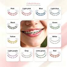 Color Rhinestone Clip-On Tooth Grillz, Sparkling Teeth Brace Mouth Jewelry, Teeth Decor For Hip Hop, Party, Holiday & Daily Wear, Multiple Colors Available. - Multicolor - View 5