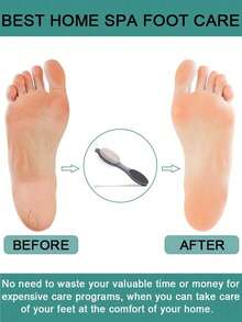 1pc Foot Pumice Stone Dead Skin Remover Brush, Unisex Foot Care Tool, Dry And Wet Use - Grey - View 4