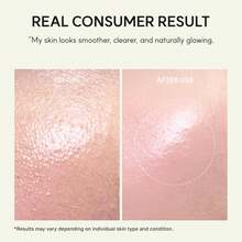 Vitamin C Booster Shot Serum With Glutathione, Niacinamide And Vitamin E For Dark Spot Care, Fine Lines & Wrinkles, Glass Skin, Korean Skincare 30ml/1.01 Fl.Oz - Collagen - 查看 6