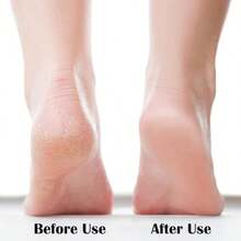 Nano Glass Foot File Dead Skin Removal Set, Used To Remove Dead Skin And Calluses, A Tool For Polishing And Rubbing Dead Skin On Heels - Clear - View 3