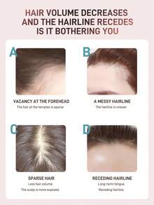 FOREVER KEY FOREVERKEY Hairline Powder berfungsi untuk menutupi akar rambut beruban dan merapikan rambut dengan daya tutup yang kuat yang menyatu sempurna dengan akar rambut alami. Sangat cocok untuk Gen Z dan pecinta Y2K untuk pesta dan kencan, serta menjadi hadiah ideal untuk ulang tahun dan Hari Ibu. - 03 COKELAT DINGIN - View 5
