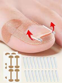 12/50/80 Pcs/Set Ingrown Toenail Filler Pads Nail Correction Stickers Ingrown Toenail Tool Painless Improvement For Ingrown Nails Suitable For Various Types Of Foot Care - Multicolor - View 3