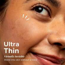 800pcs Transparent Skin Tone Scar Cover Patches, Invisible Concealment, Gentle & Non-Irritating, Hydrocolloid Material, Alcohol-Free, Multiple Sizes Available - Transparent - View 2