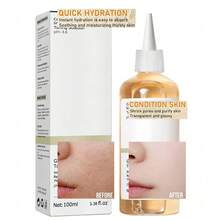 Toner Asam Glikolat, Toner Eksfoliasi Asam Glikolat 7%, Dapat Melembapkan dan Mengondisikan Kulit, 100ml - air asam asetat - View 2