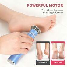 Rechargeable Electric Foot Callus Remover, Wireless Pedicure Tool With 3 Replacement Grinding Heads, 2‑Speed Adjustable Foot File For Dead Skin Hard Cracked Heels - Multicolor - View 1