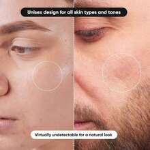 800pcs Transparent Skin Tone Scar Cover Patches, Invisible Concealment, Gentle & Non-Irritating, Hydrocolloid Material, Alcohol-Free, Multiple Sizes Available - Transparent - View 4