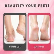 Rechargeable Electric Foot Callus Remover, Wireless Pedicure Tool With 3 Replacement Grinding Heads, 2‑Speed Adjustable Foot File For Dead Skin Hard Cracked Heels - Multicolor - View 2