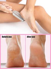 Stainless Steel Foot File, Suitable For Foot Care And Spa, Used To Remove Dead Skin, Cracks And Calluses. Foot File Pumice Stone, Corn Remover, Foot Treatment Tool, Professional Foot Care, Unisex - Multicolor - View 2