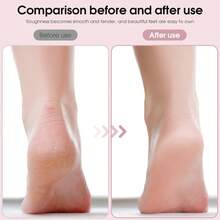 Rechargeable Electric Foot File, The Ultimate Tool For Removing Dead Skin And . Designed Specifically For Thick Skin, It'S Perfect For Dry, Hard, And Cracked Skin. Ideal For Daily Foot Care At Home And Makes A Great Gift For Family Members. - Handheld - View 9