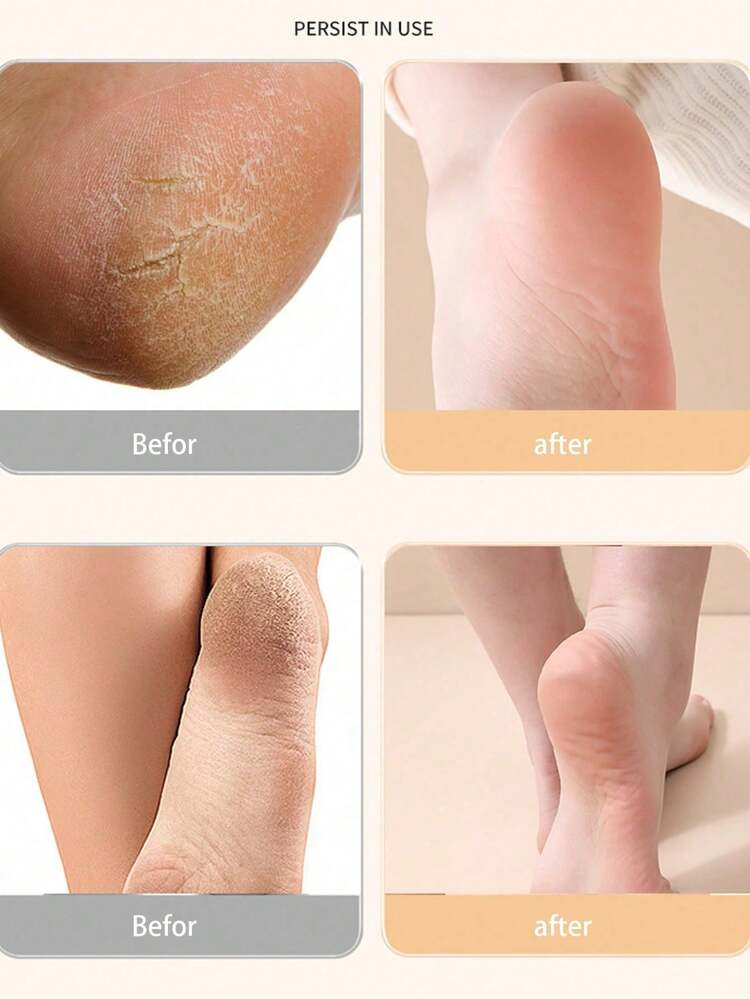 1 Pair Whitening Moisturizing Silicone Socks, Suitable For Dry And Cracked Foot Care, Gel Heel Leg Warmers, For Foot Moisturizing - Black - View 5