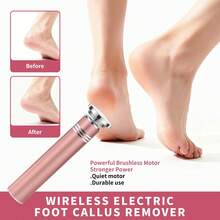 Rechargeable Electric Foot Callus Remover, Wireless Pedicure Tool With 3 Replacement Grinding Heads, 2‑Speed Adjustable Foot File For Dead Skin Hard Cracked Heels - Multicolor - View 8