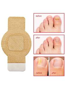 5pcs/Set Nail Protection Stickers, Suitable For Men And Women Daily Use, Exquisite Gift - A - View 9