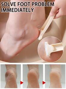 Foot Scraper Foot Scraper Dead Skin & Callus Removal Tool Dead Skin Removal Tool Foot Scraper Foot Pumice Stone Foot Rasp Foot Care Tool Personal Care Product - Multicolor - View 3