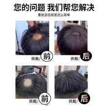Unisex Front Hairline Bangs & Sideburns Hair Piece, Invisible Bald Spot Cover Hair Patch For Men - Black - View 3