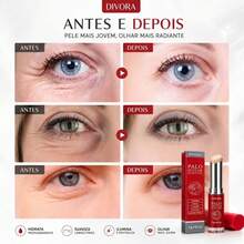 Creme Hidratante Para Olhos Reduz Inchaço E Linhas De Expressão - Retinol - Visão 5