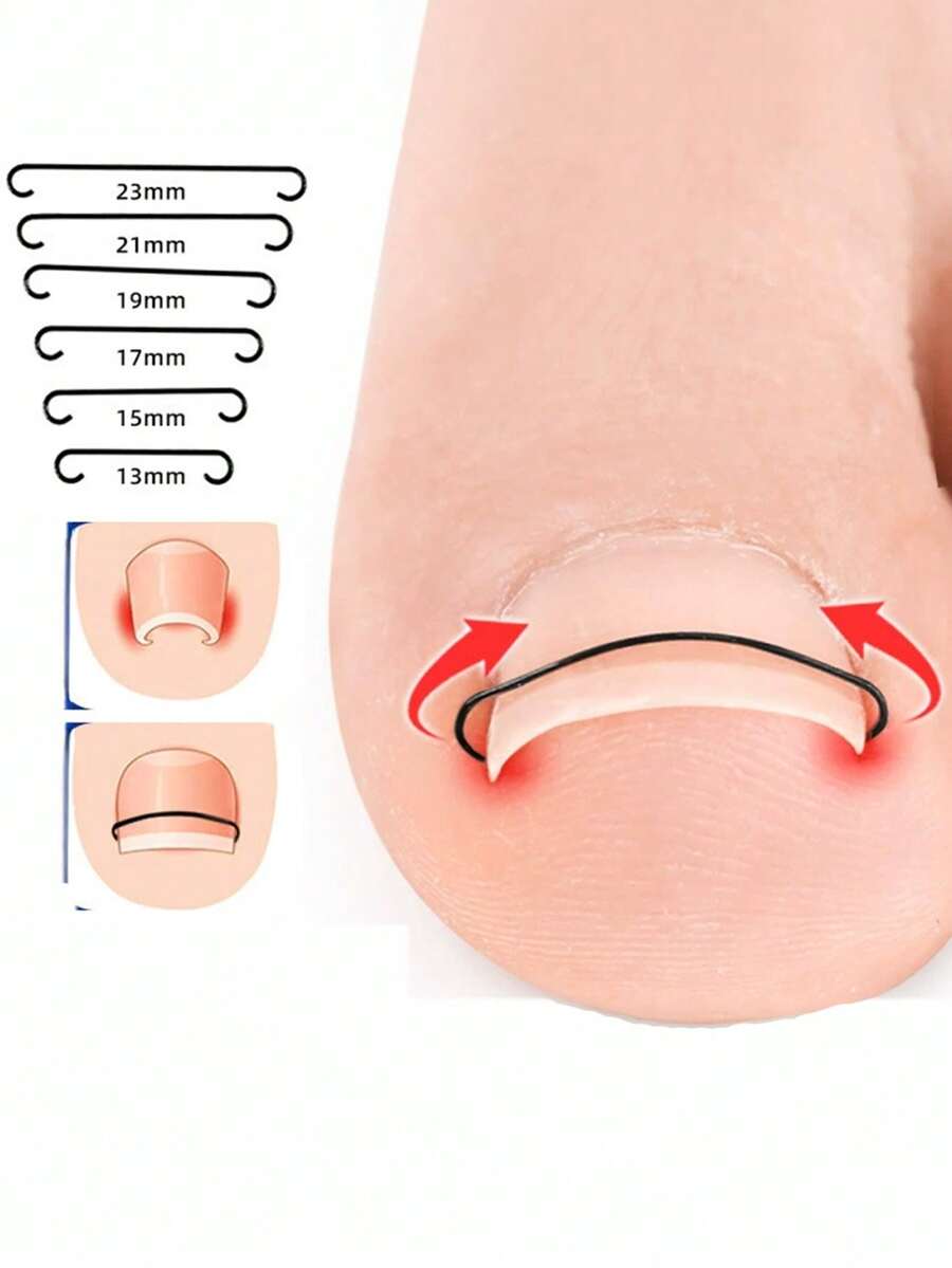 1pc Toe Bracket, Flexible Toe Nail Straightening Strip, Suitable For Curved Toe Nails, Invisible Toe Nail Lifting Support Clip, Portable Foot Care Pedicure Tool, Suitable For Wearing Shoes, Walking And Daily Use - Multicolor - View 1