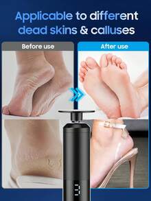 Electric Foot Callus Remover, 2-In-1 Foot Polisher And Nail Polisher, With 10pcs Sandpaper Discs, 6pcs Nail Polishing Rings, Multi-Functional Professional Foot Callus Remover, Hand Care Tool, Removes Dead Skin, Suitable For Home Foot And Hand Care, Unisex - View 5