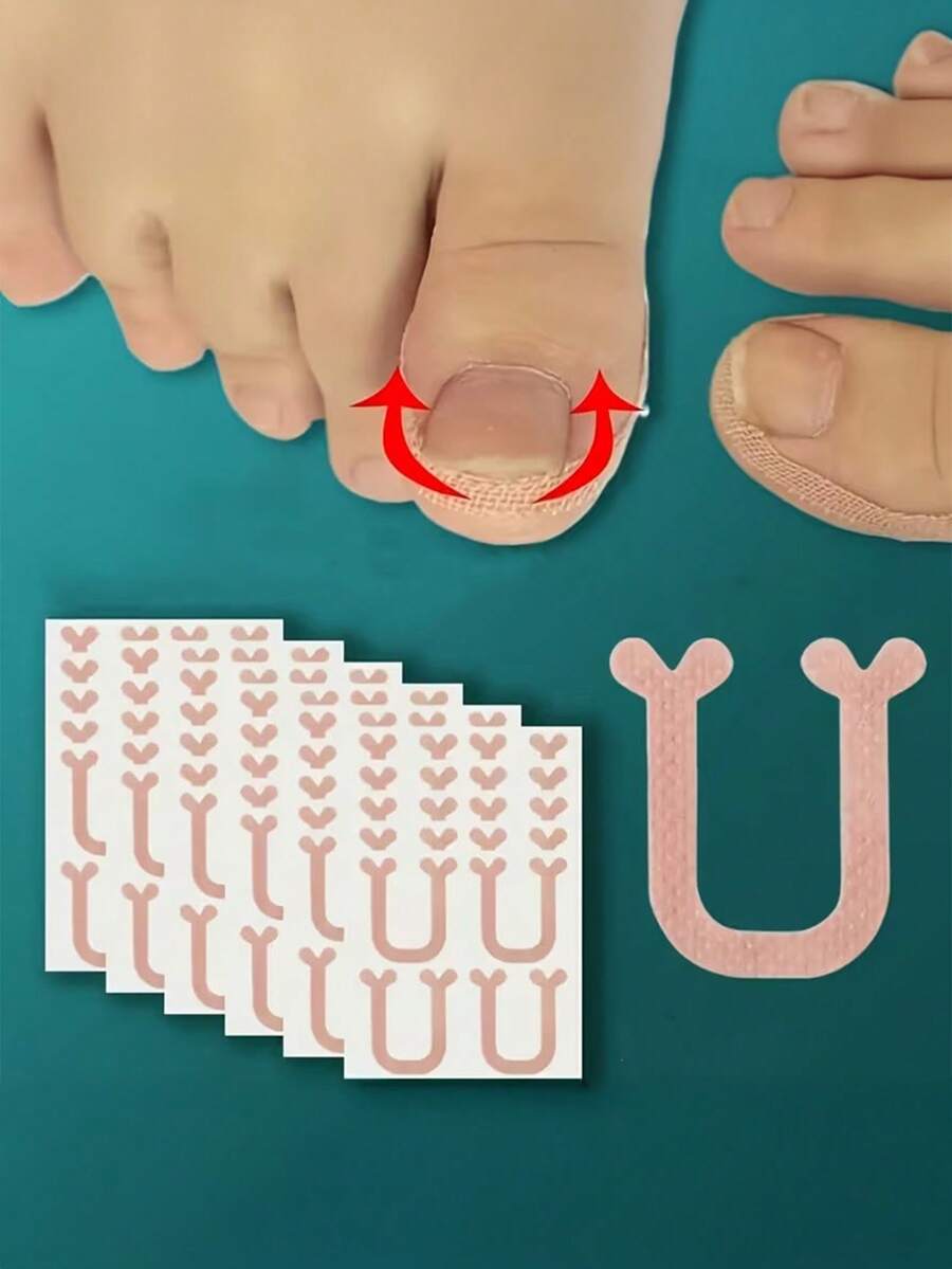 10pcs U-Shaped Toenail Correction Strips, Adhesive Nail Lifting Patches For Curved Toenails, Flexible Nail Straightening Stickers, Invisible Toe Nail Support For Daily Foot Care, Pedicure & Home Use - Multicolor - View 1