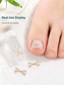 1pc X-Shaped Toenail Corrector Clip, Nickel Alloy & TPU Material Nail Correction Bracket, Flexible Invisible Nail Lift Patch, Suitable For Curved Toenails, Portable Foot Care Pedicure Tool, Suitable For Wearing Shoes And Daily Walking - Multicolor - View 1