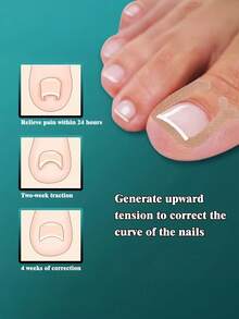 10pcs U-Shaped Toenail Correction Strips, Adhesive Nail Lifting Patches For Curved Toenails, Flexible Nail Straightening Stickers, Invisible Toe Nail Support For Daily Foot Care, Pedicure & Home Use - Multicolor - View 3