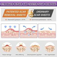 Scar Cover - 1PC - View 10