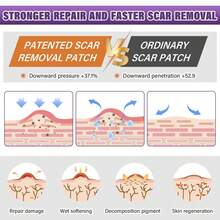 Scar Cover - 1PC - View 11