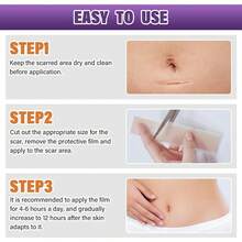 Scar Cover - 1PC - View 6