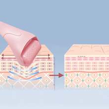 Dam Facial Ice Roller, Massage And Care Instrument. Plastic Head - Pink - View 4