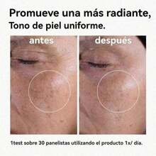 The Ordinary Glycolic Acid 7% Toning Solution 240ml, Exfoliante Facial para Todo Tipo de Piel, Loción Renovadora de Noche, Ilumina y Suaviza el Rostro - 1PCS - Ver 4