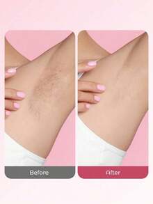 2-In-1 Electric Shaver, Wireless Bikini Trimmer For Women, Detachable Heads,  Wet & Dry Waterproof Design, USB Rechargeable, Portable, Suitable For Bikini Line, Underarms, Legs & Body Hair Removal, Travel Essential - Multicolor - View 5