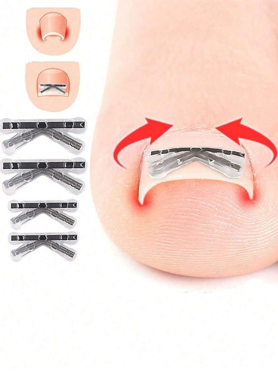 2pcs Toenail Correction Braces, Flexible Nail Straightening Strips For Curved Toenails, Invisible Nail Lifting Support Clips, Compact Pedicure Foot Care Tool, Comfortable For Shoes, Walking & Daily Use - Multicolor - View 1