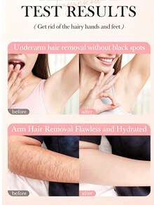 OTOU 2‑In‑1 Hair Removal Cream With Scraper, Gentle Moisturizing Soothing Depilatory Cream For Body & Bikini Line, Smooth Hair‑Free Skin - 2-in-1 Hair Removal Cream 1pc (with Scraper) - View 11