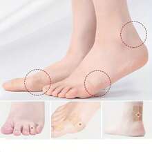 3/6 Gulungan Pita Pelindung Anti Gesekan Transparan, Balutan Perekat Diri yang Lembut dan Bernapas, Pas untuk Jari Kaki, Tumit, Pergelangan Kaki, dan Jari Tangan, Nyaman Dipakai - Berbagai Gaya - View 4