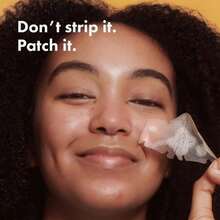 360+10pcs Combination Pack Scar Concealment Patches, Gentle & Non-Irritating, Comfortable Material, Hydrocolloid, Invisible - View 6