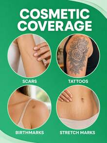 Scar Patches, Flesh-Colored, Conceal Scars, Invisible Design, Cuttable, Waterproof, Perfect Fit, Breathable And Not Stuffy, Suitable For Multiple Areas. - Silicone Scar Sheets - View 4