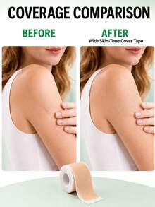 Scar Patches, Flesh-Colored, Conceal Scars, Invisible Design, Cuttable, Waterproof, Perfect Fit, Breathable And Not Stuffy, Suitable For Multiple Areas. - Silicone Scar Sheets - View 1