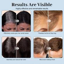 VERONNI 10g Hairline Shadow Powder, Anti-Staining, Instant Coverage For Hairline And Roots, Waterproof Hairline Filler Powder, Natural Look, Large Capacity 7 Colors Available - Multicolor - View 5